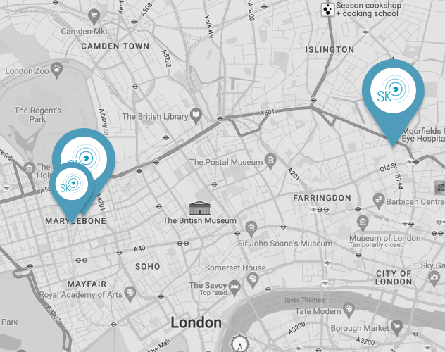 When Can I Wash My Hair After Cataract Surgery Sharmina Khan